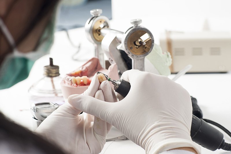 Confección de Prótesis Dentales en Irun