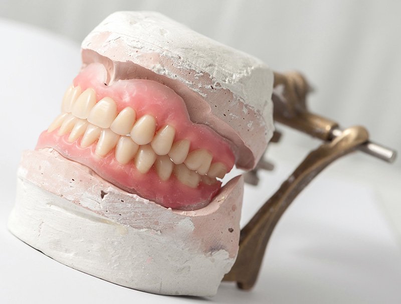 Laboratorio propio de Prótesis Dentales