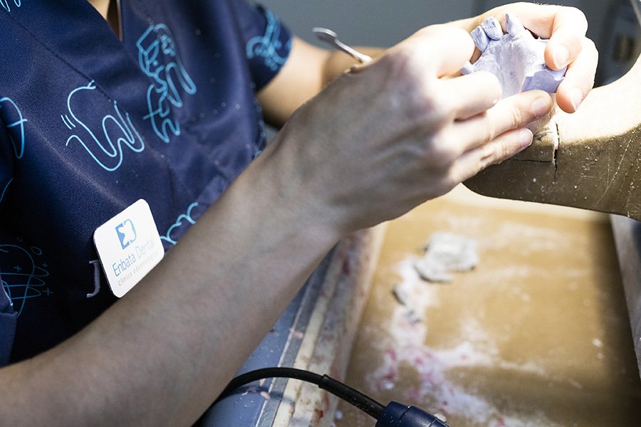 Laboratorio de Prótesis Dentales en Irun